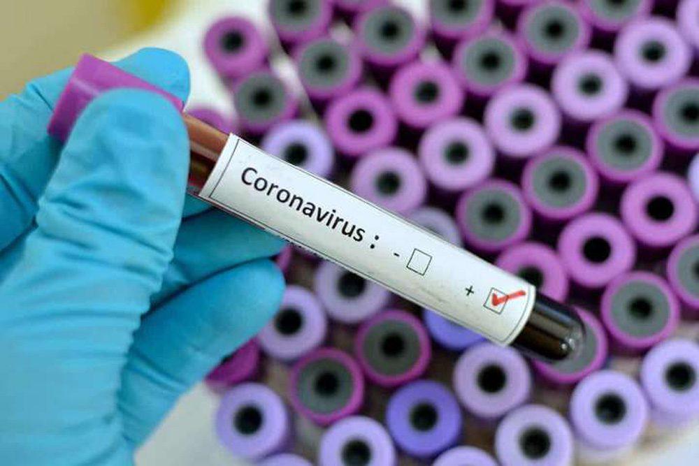 На Рівненщині станом на ранок 12 червня зафіксовано 11 нових випадків COVID-19