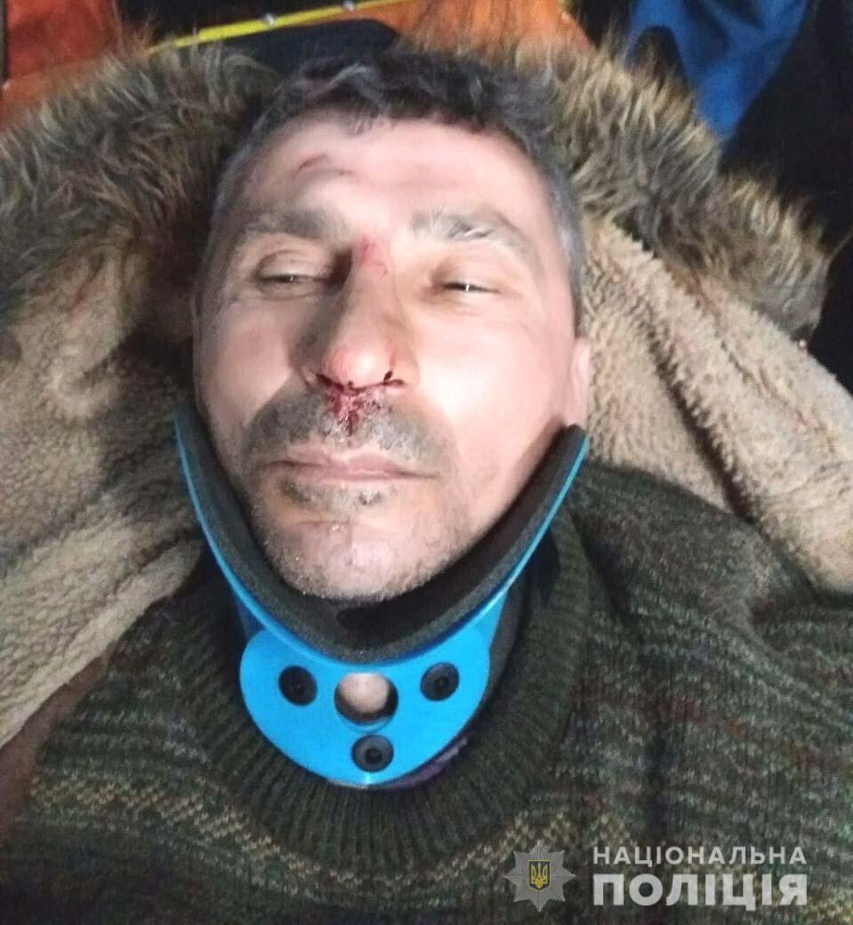 На Рівненщині поліцейські встановлюють особу померлого пішохода та розшукують водія