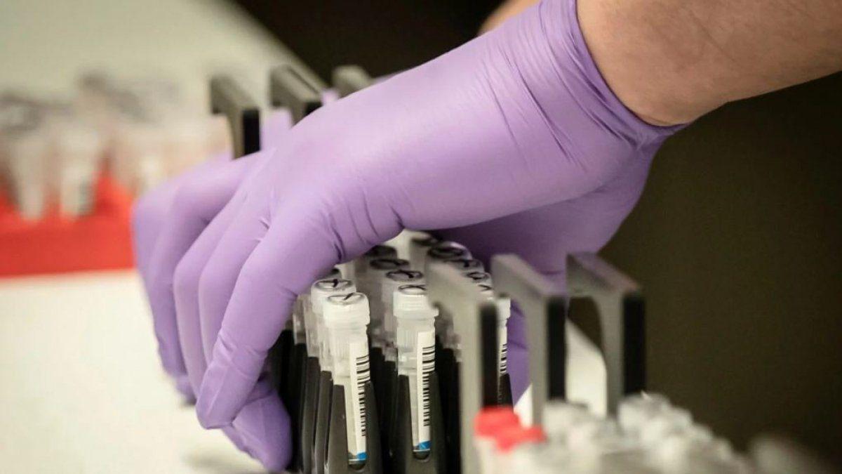 На наступному тижні в Україні планують тестувати на антитіла до COVID-19