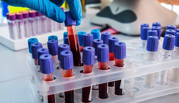 В Україні виявили 1106 нових випадків COVID-19 В Україні виявили 1106 нових випадків COVID-19