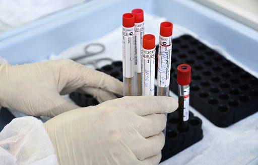 За минулу добу 810 випадків захворювань на коронавірус в Україні