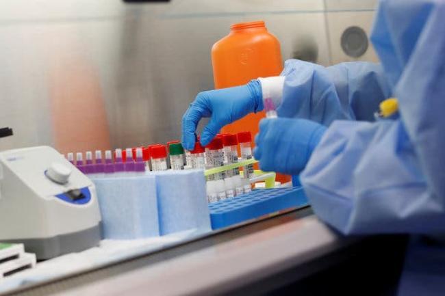 У більш як тисячі українців виявили коронавірус за минулу добу