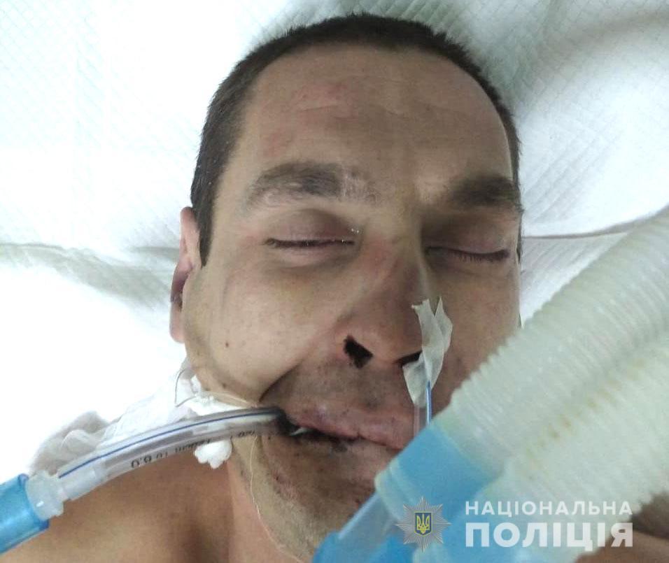 Поліцейські встановлюють особу чоловіка, якого без свідомості знайшли на території лікарні