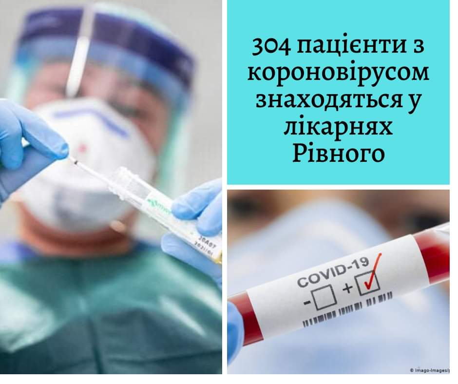 У медичних закладах Рівного знаходяться 304 пацієнта з діагнозами чи підозрами на COVID-19