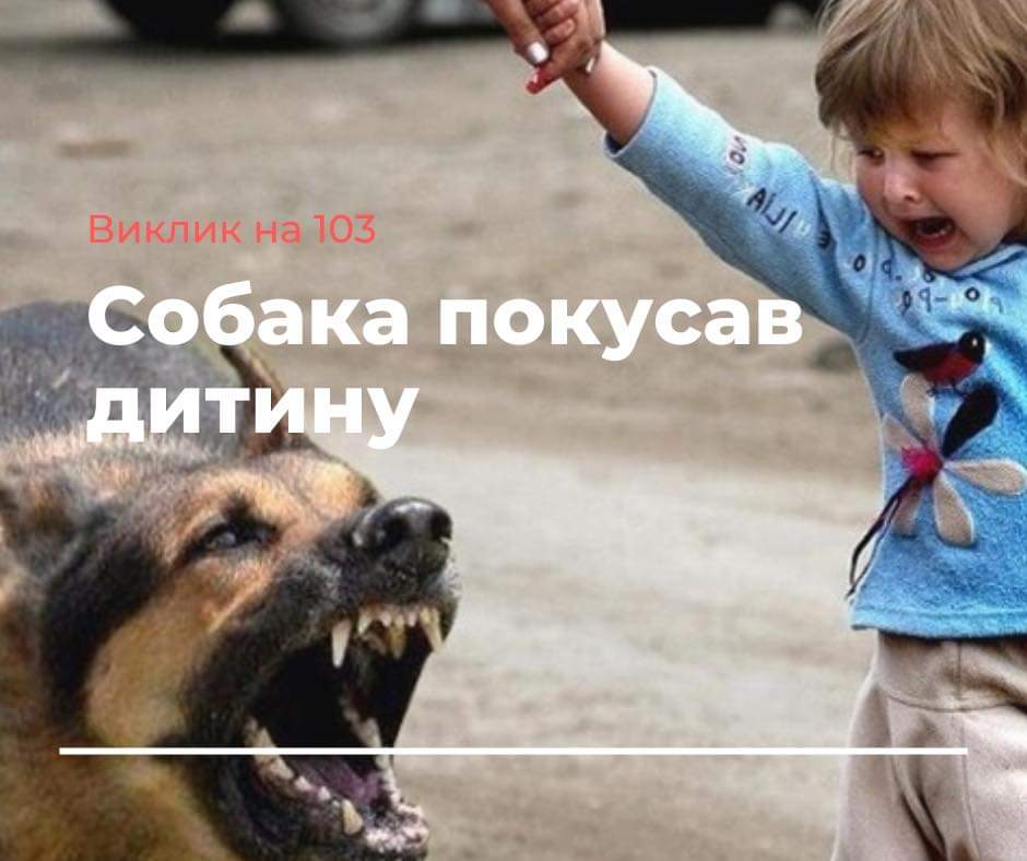 На Рівненщині собака покусала дитину