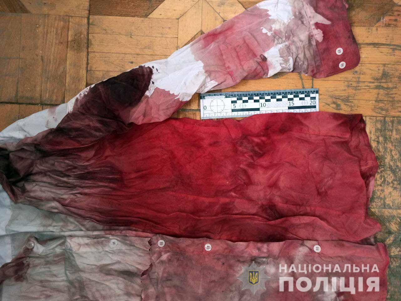 Порізав кума: поліцейські повідомили про підозру жителю Вараського району Порізав кума: поліцейські повідомили про підозру жителю Вараського району