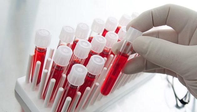 У Британії почали випробування тесту, який визначатиме рак ще до появи симптомів