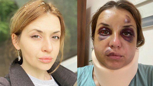 Лугова на яку напали в потязі отримає компенсацію від Укрзалізниці