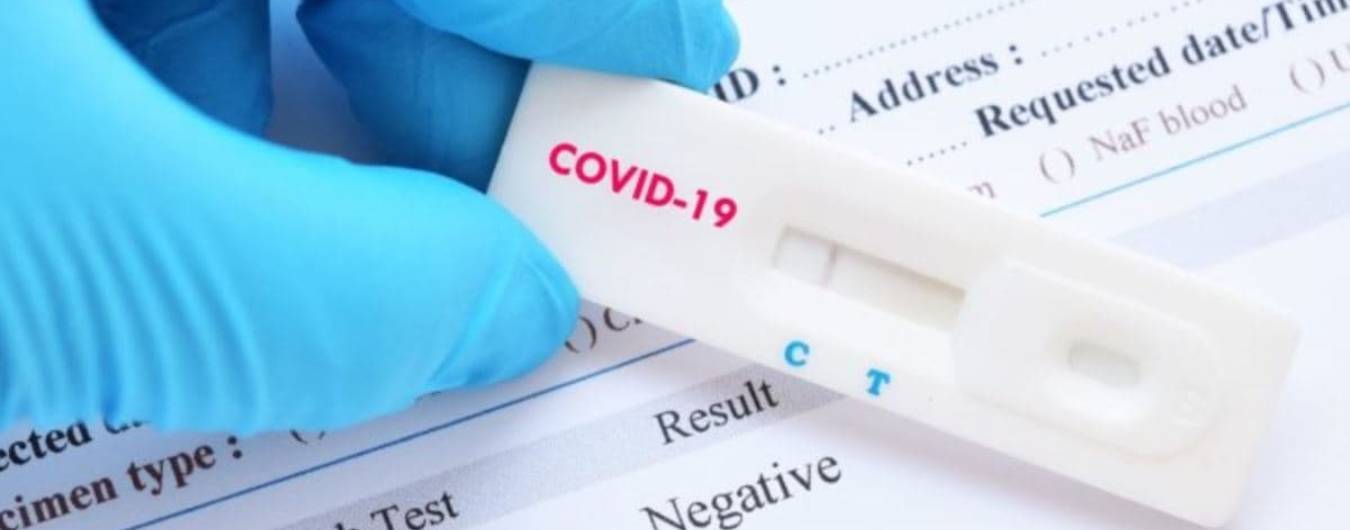 Covid прирівняють до інших хвороб та відмінять тестування