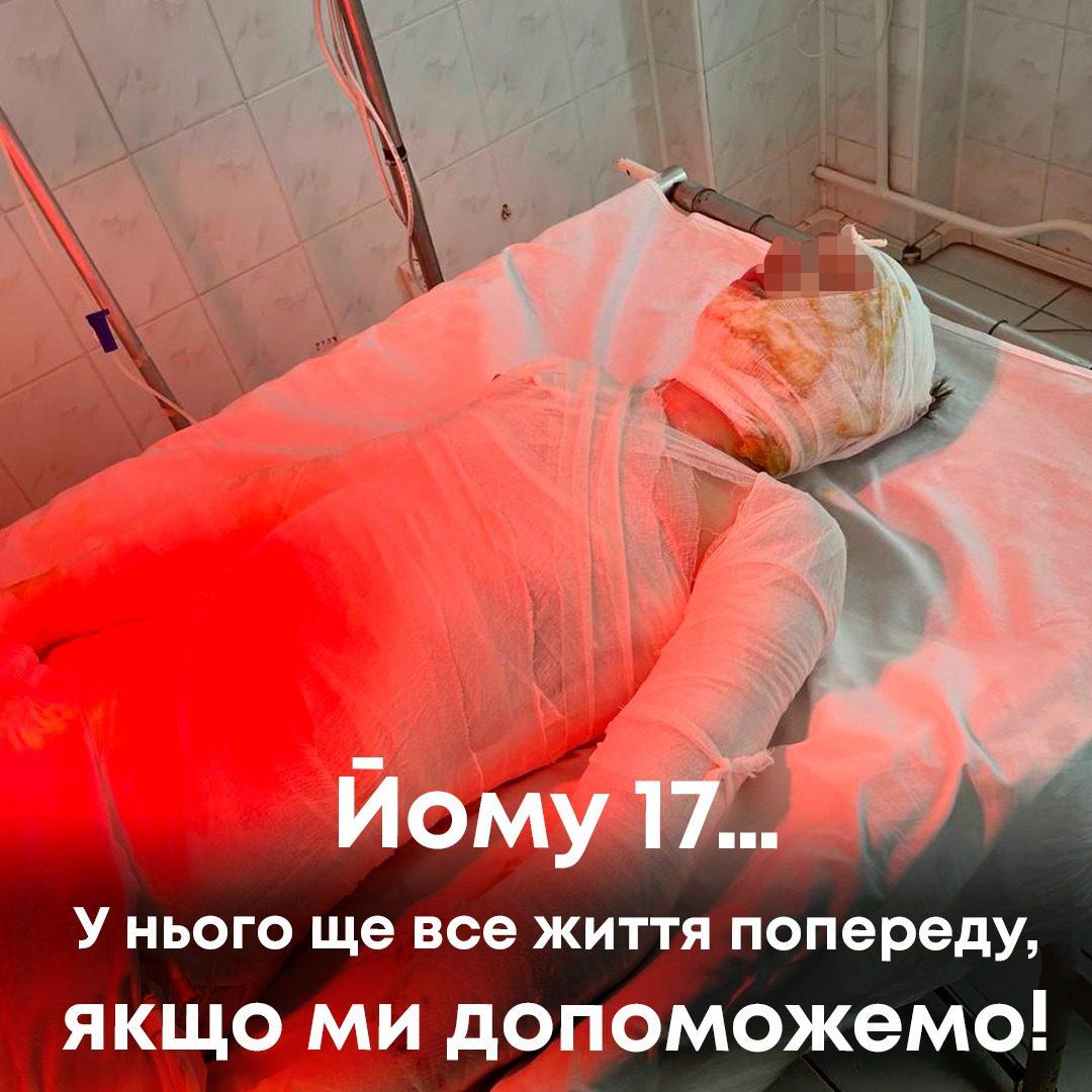 17-річному юнаку, постраждалому біля Рівного, потрібна допомога