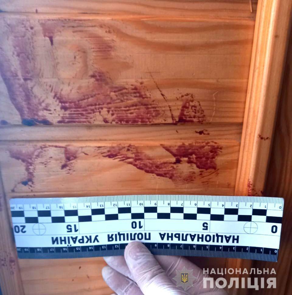 За спробу вбивства односельців поліцейські затримали жителя Рівненського району