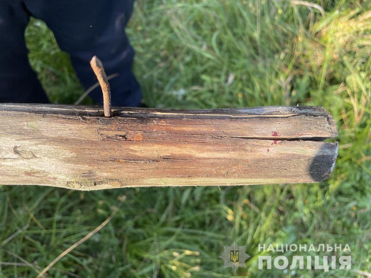 Потрапив у лікарню після сусідських розбірок житель Сарненщини