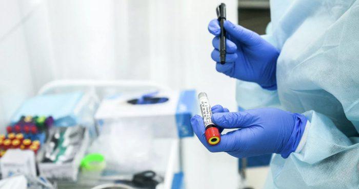 Захворюваність на COVID-19 на Рівненщині знову зростає