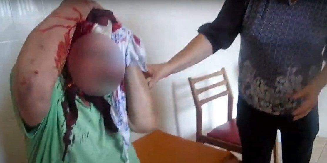 На Дубенщині поліцейський доставив у лікарню травмованого чоловіка (відео)