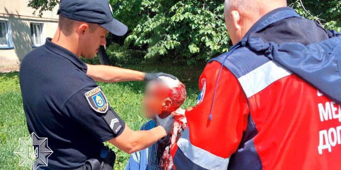Дубенські патрульні врятували чоловіка, який стікав кров’ю
