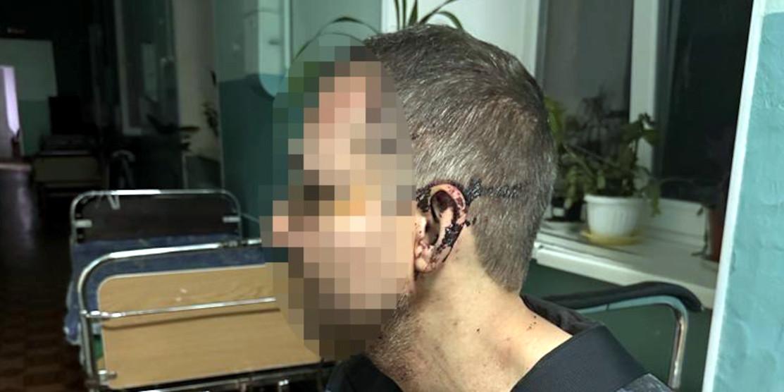Кривавий інцидент стався в одній з військових частин Одеської області