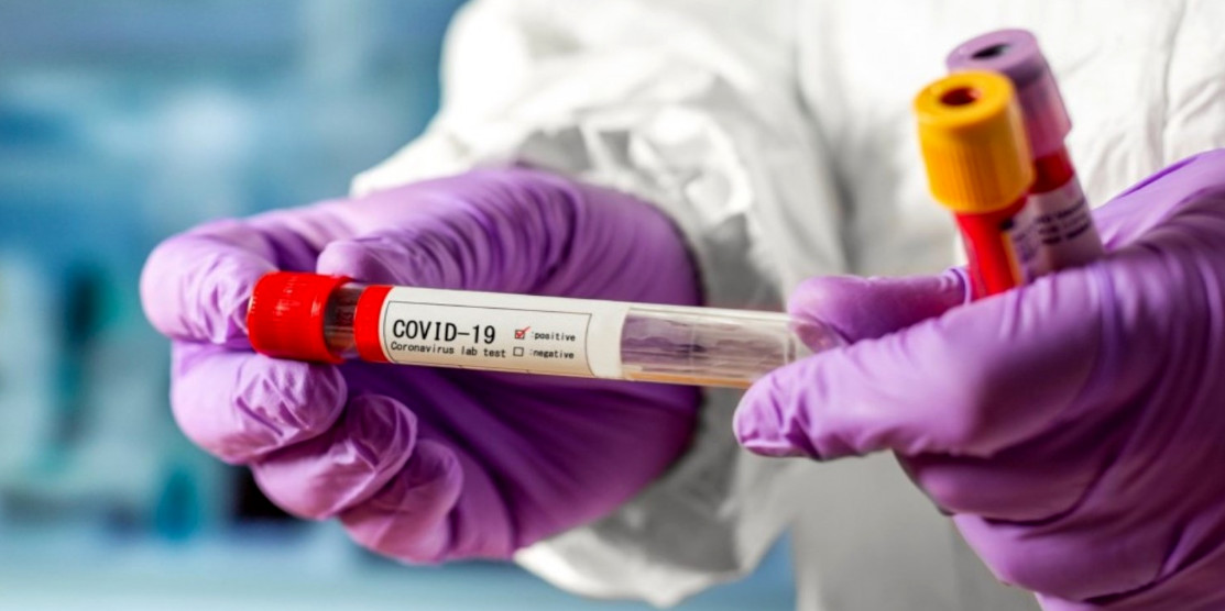 В Україні виявили нові субваріанти COVID-19 – «Stratus» і «Nimbus». Які симптоми