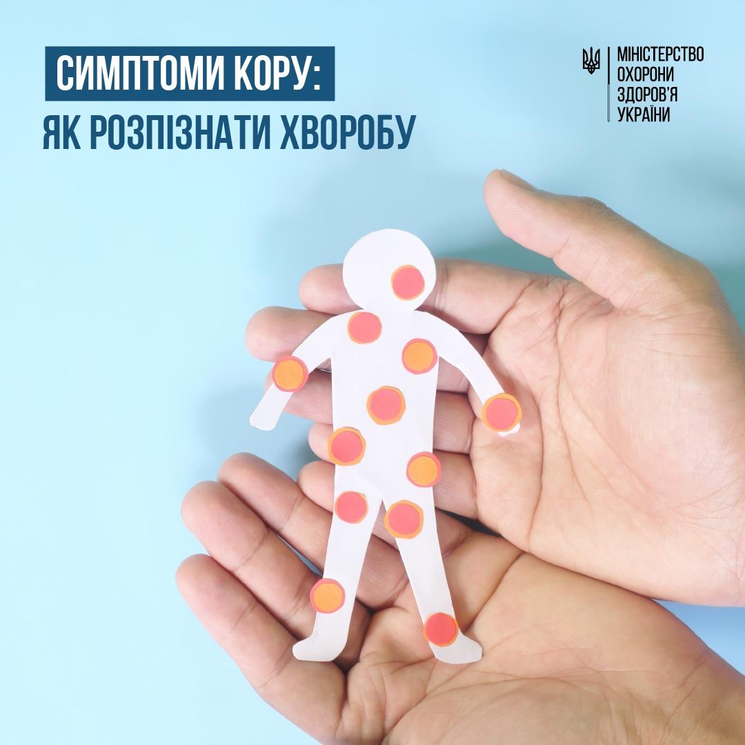 кір симптоми