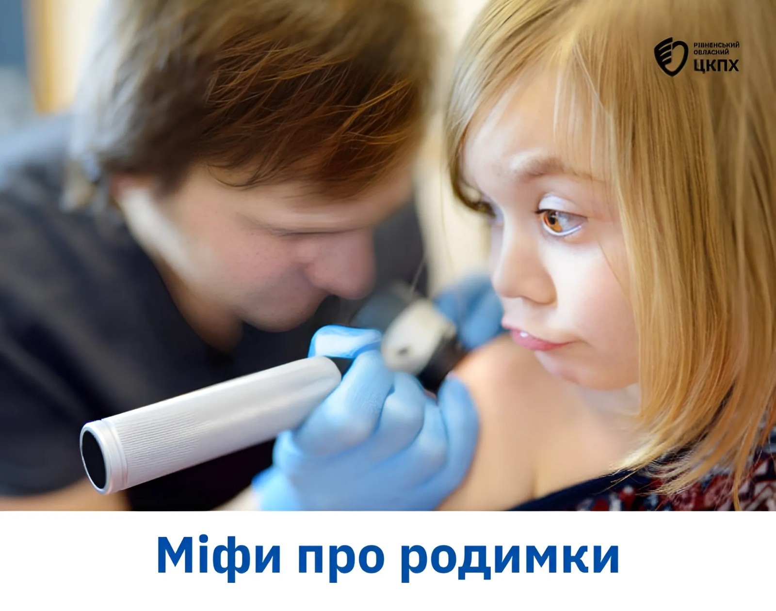 Чому з’являються родимки: міфи і факти