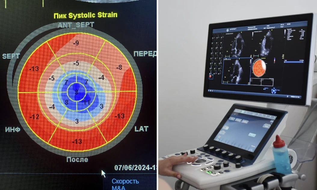Патології серця на Рівненщині діагностуватимуть новітньою системою