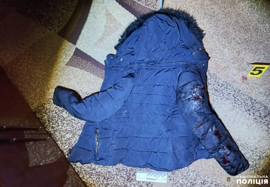 За замах на умисне вбивство знайомої на ґрунті ревнощів затримали рівнянина - фото 1