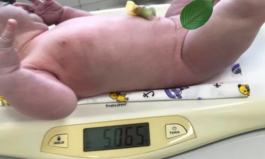 Хлопчик з вагою у понад 5 кг народився на Рівненщині