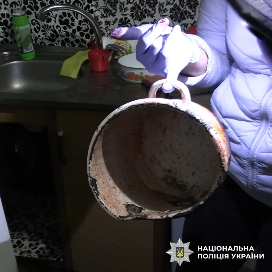 У Києві, через небажання слухати російську музику, зарізали чоловіка - фото 1 У Києві, через небажання слухати російську музику, зарізали чоловіка - фото 1