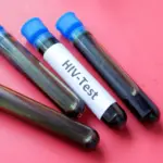 На Рівненщині стартує Європейський тиждень безоплатного тестування на ВІЛ Тестування на ВІЛ. Пробірки.