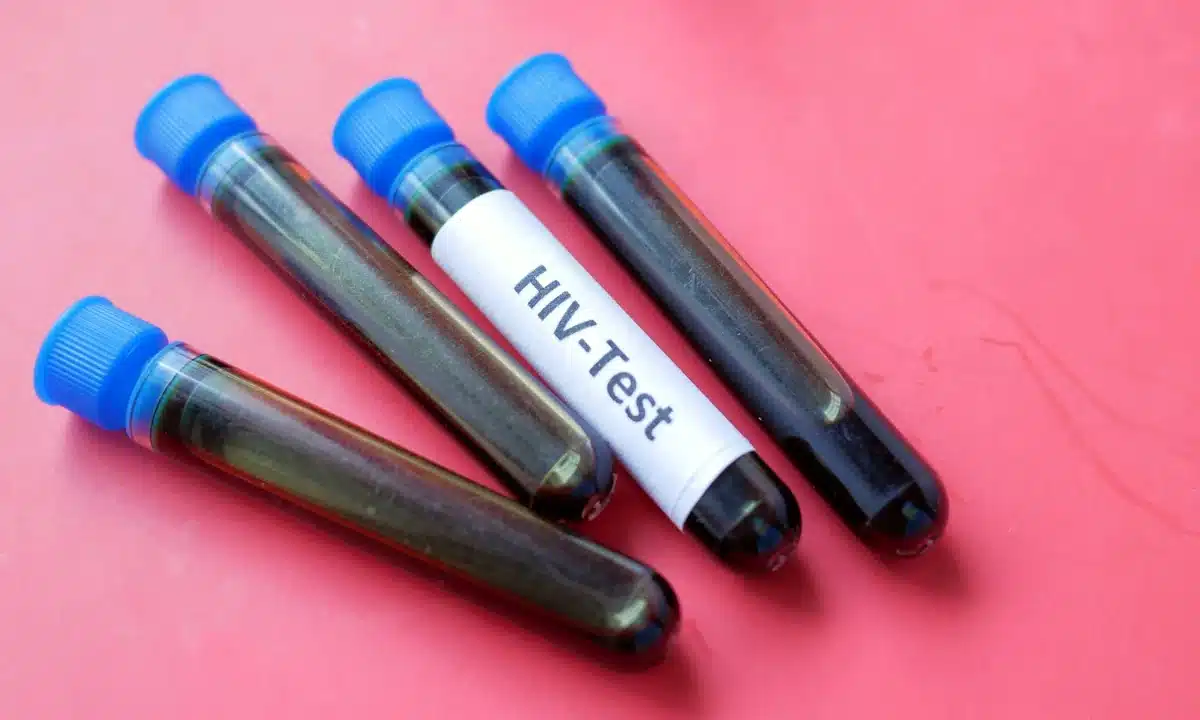 Тестування на ВІЛ. Пробірки.