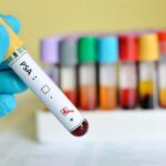 Понад 300 рівнян перевірили здоров’я в рамках Movember Аналіз ПСА