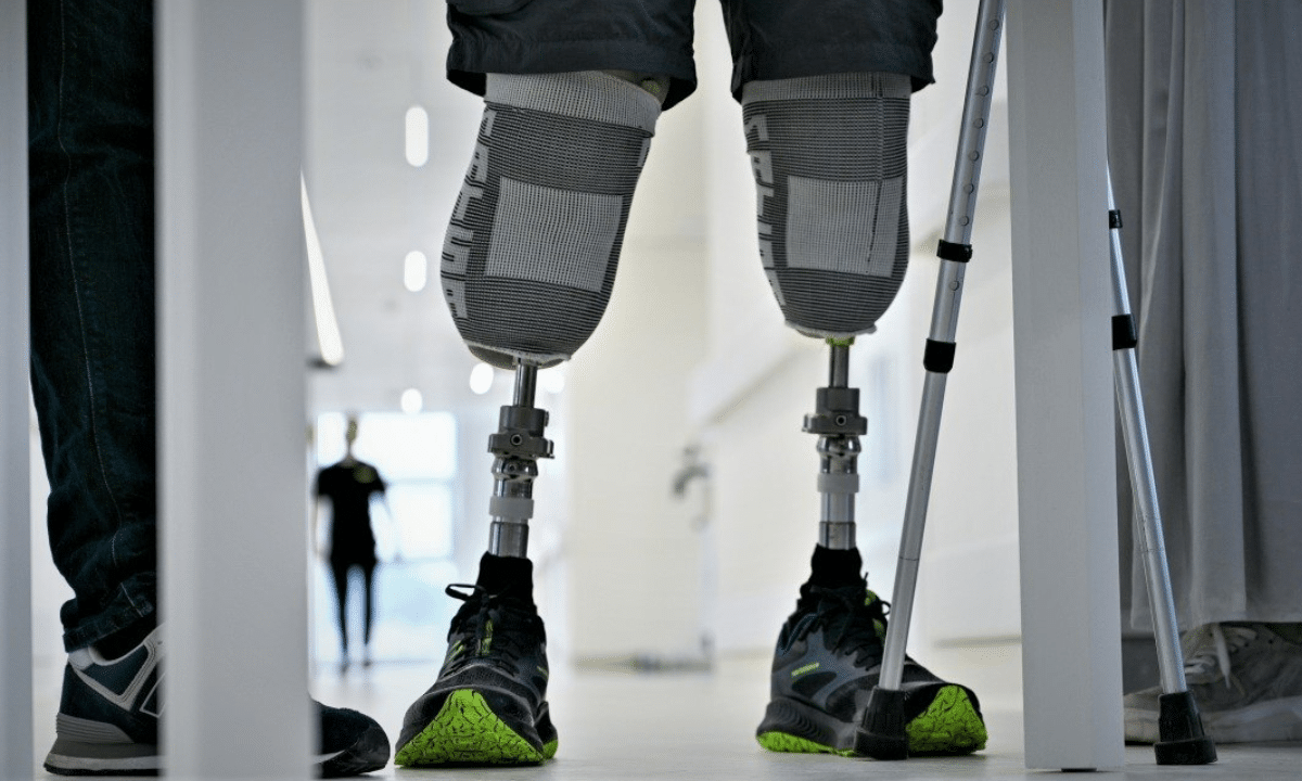 Безоплатні засоби реабілітації: що держава надає українцям Людина з протезами обох нижніх кінцівок стоїть у медичному закладі, поруч видно милиці та елементи реабілітаційного простору.