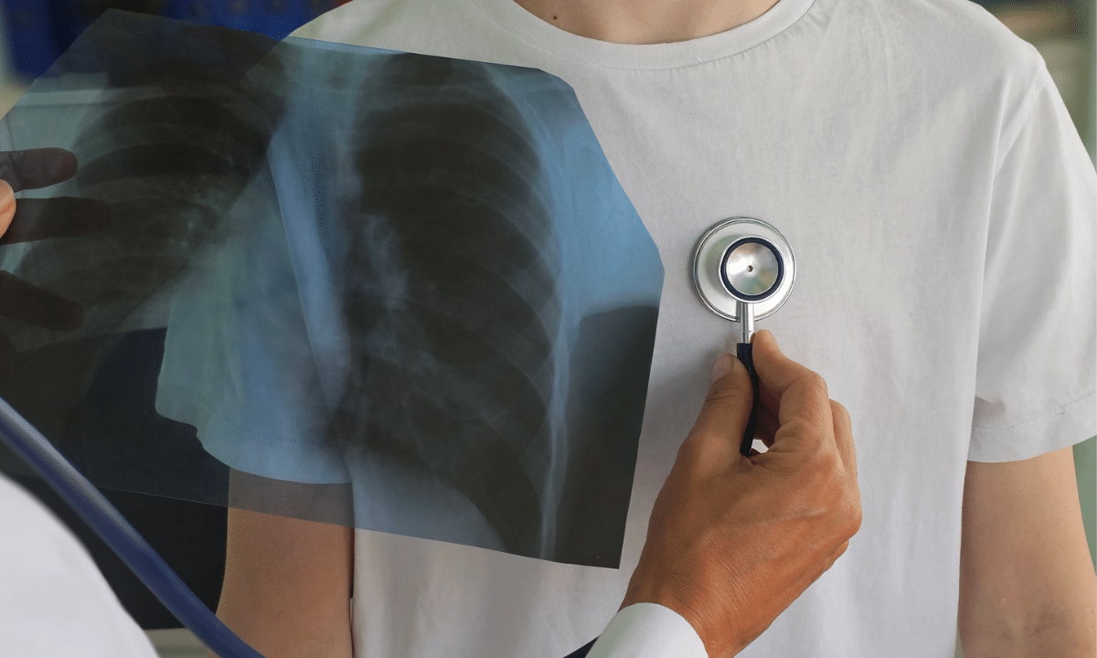 У 14% обстежених на Рівненщині виявили латентний туберкульоз Лікар слухає дихання пацієнта через стетоскоп.