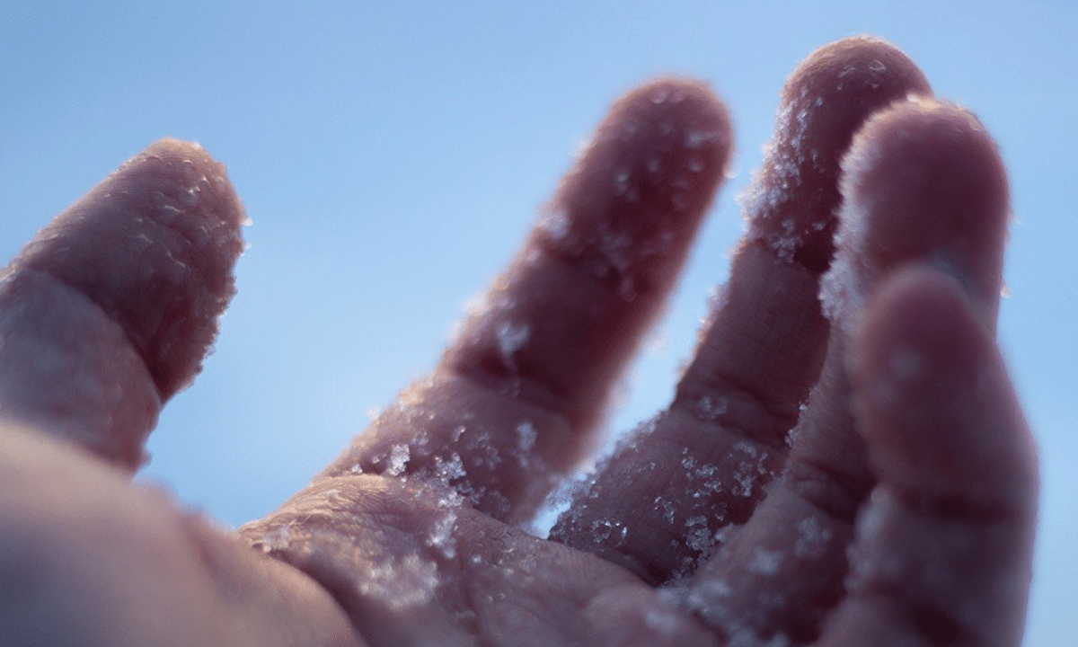 Обмороження пальців