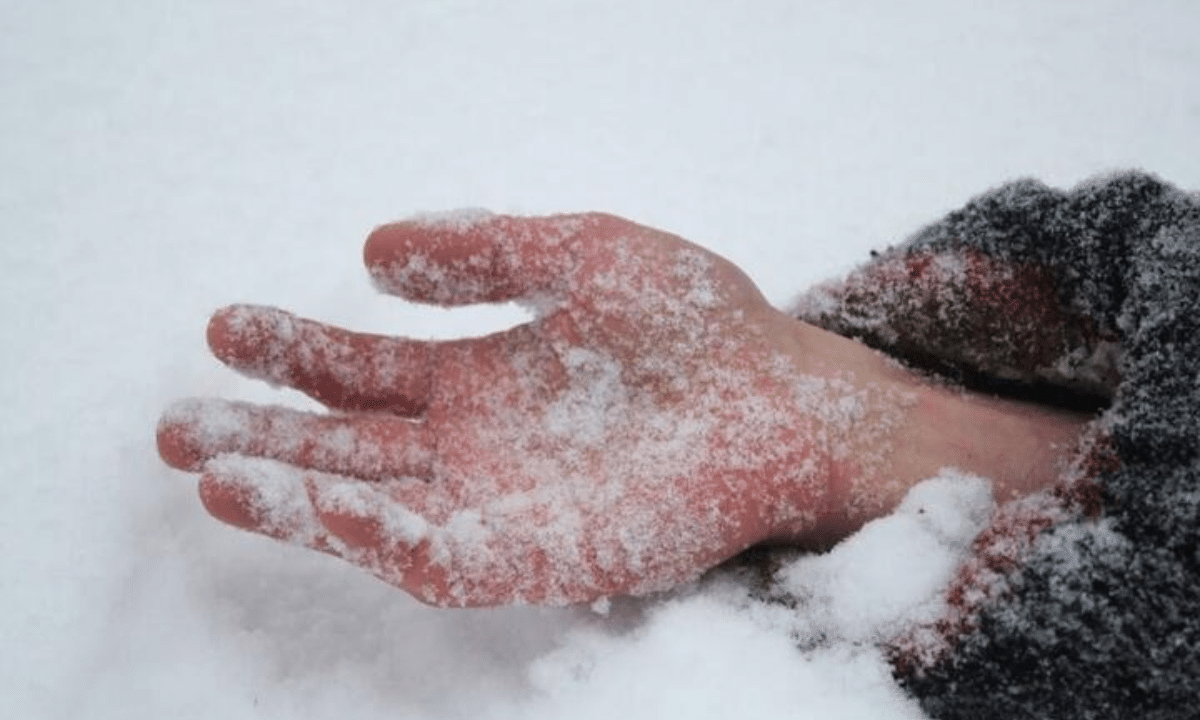 Три випадки переохолодження на Рівненщині