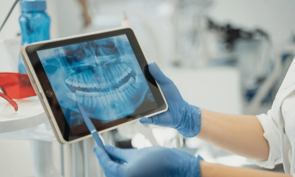 Постраждалі від Чорнобильської катастрофи зможуть отримати безоплатне зубопротезування Протезування зубів.