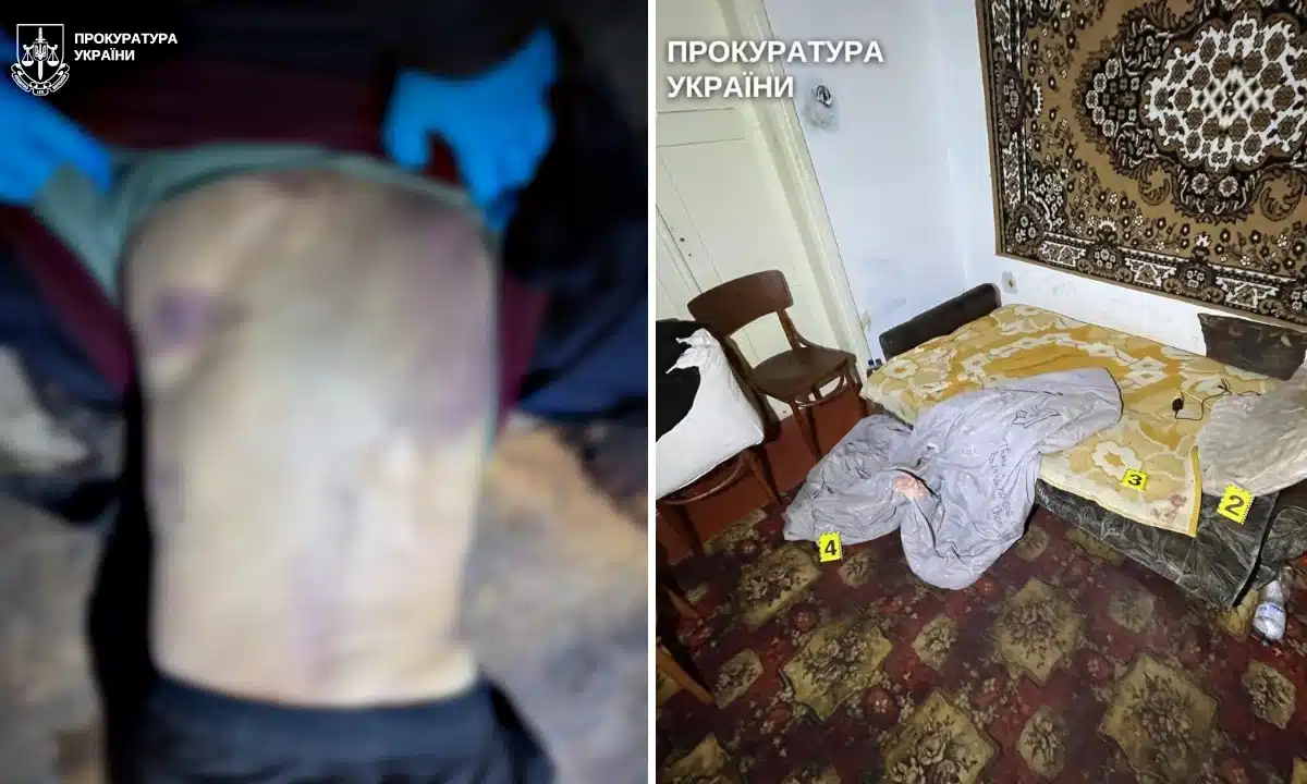 Спина побитого чоловіка і місце злочину.