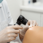 Лікар оглядає родимку.