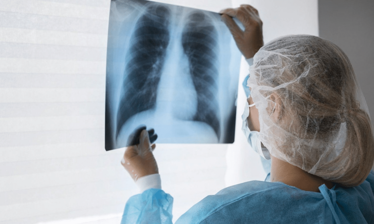 цифровий рентген