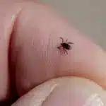 Кліщ на руці.