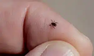 Кліщ на руці.